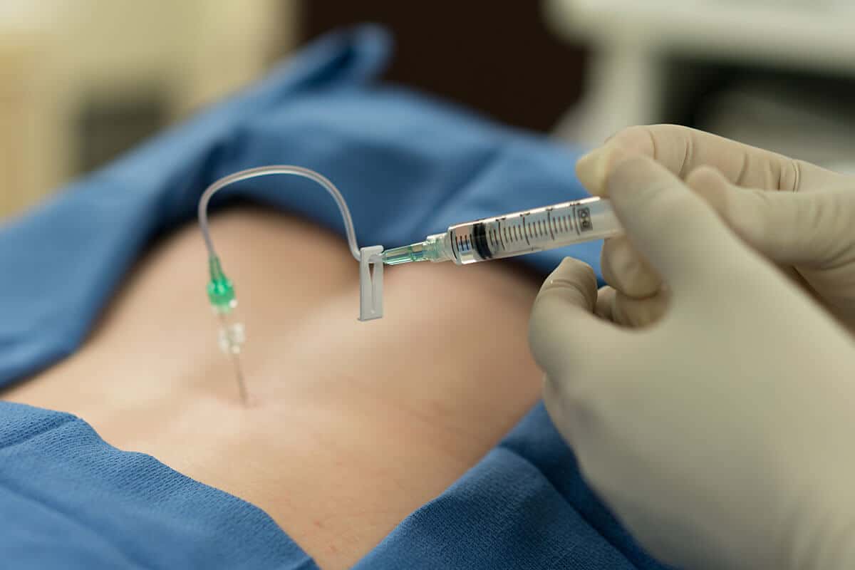 Epidural Steroid Injections for Sciatica Relief Epidural Steroid Injections for Sciatica Relief