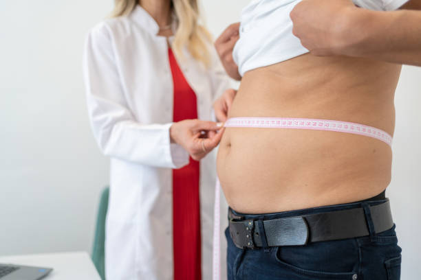 Liposuction surgery Liposuction surgery in Dubai