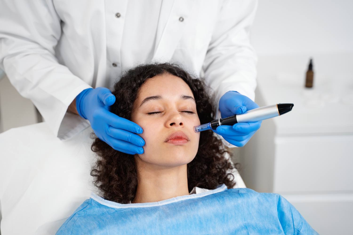 Microneedling for acne scarring Toronto Microneedling for acne scarring Toronto